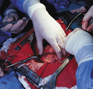 Photo of surgery