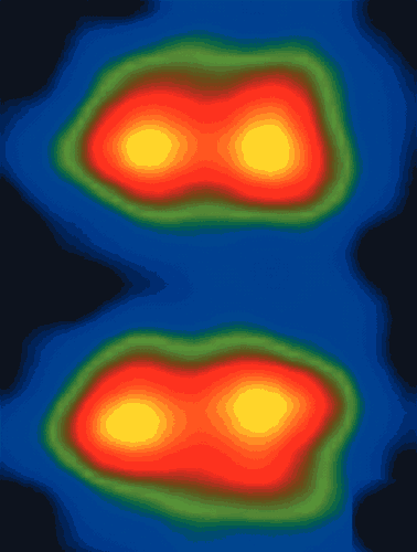 electron microscope images atom