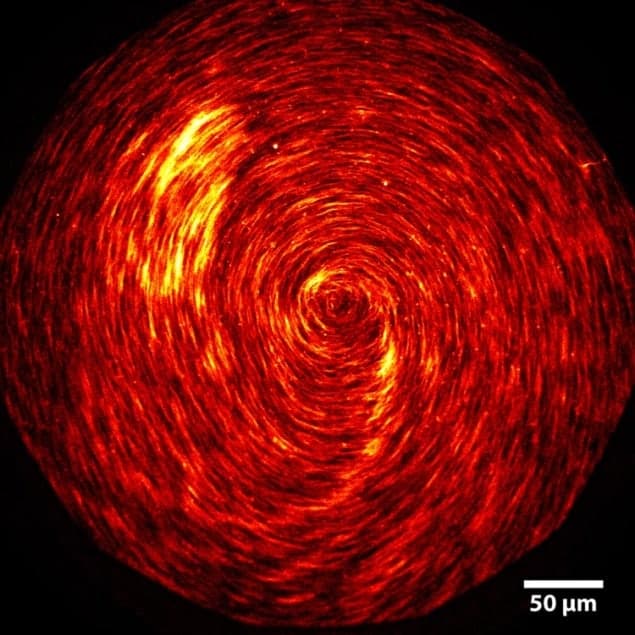 Micrograph showing swirling actin