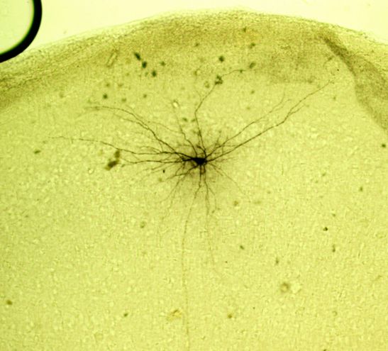 Cell in the entorhinal cortex