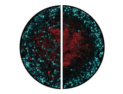 Microscope images showing dividing and dying tumour cells
