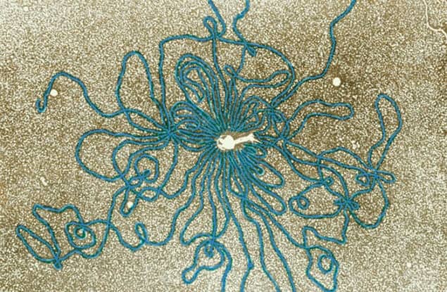 Transmission electron micrograph of DNA from a bacteriophage Transmission electron micrograph of DNA from a bacteriophage