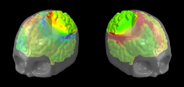 Simulating how the brain responds to internal pressure