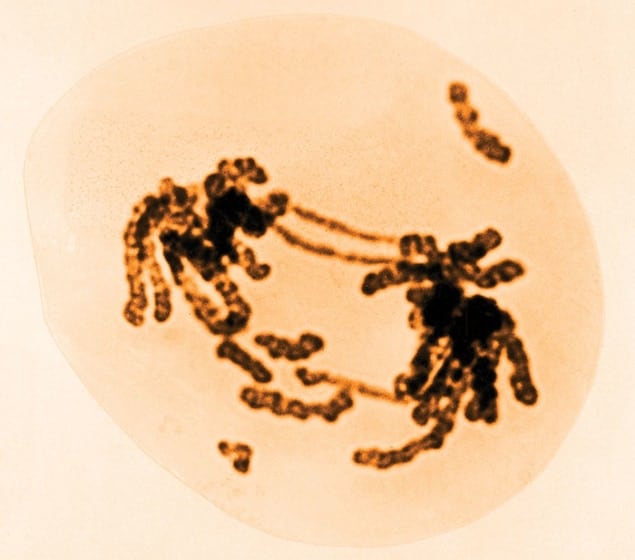 Colour-enhanced transmission electron micrograph showing radiation damage to chromosomes. The chromosomes appear as dark blobs with tendrils and bits and pieces of material scattered around the field of view