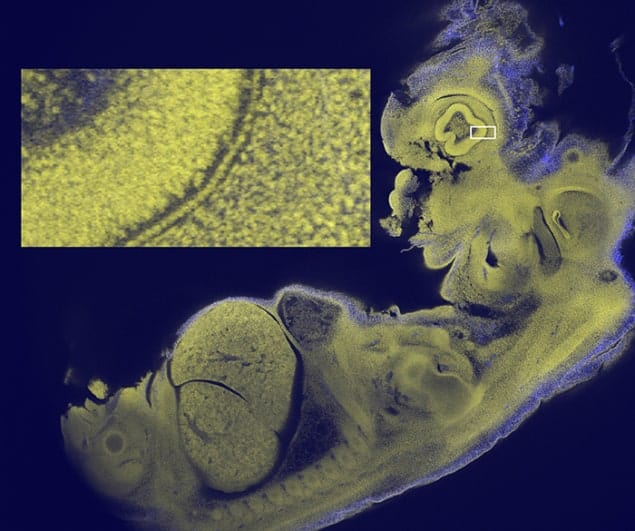 Image of a mouse embryo taken using the new mesolens