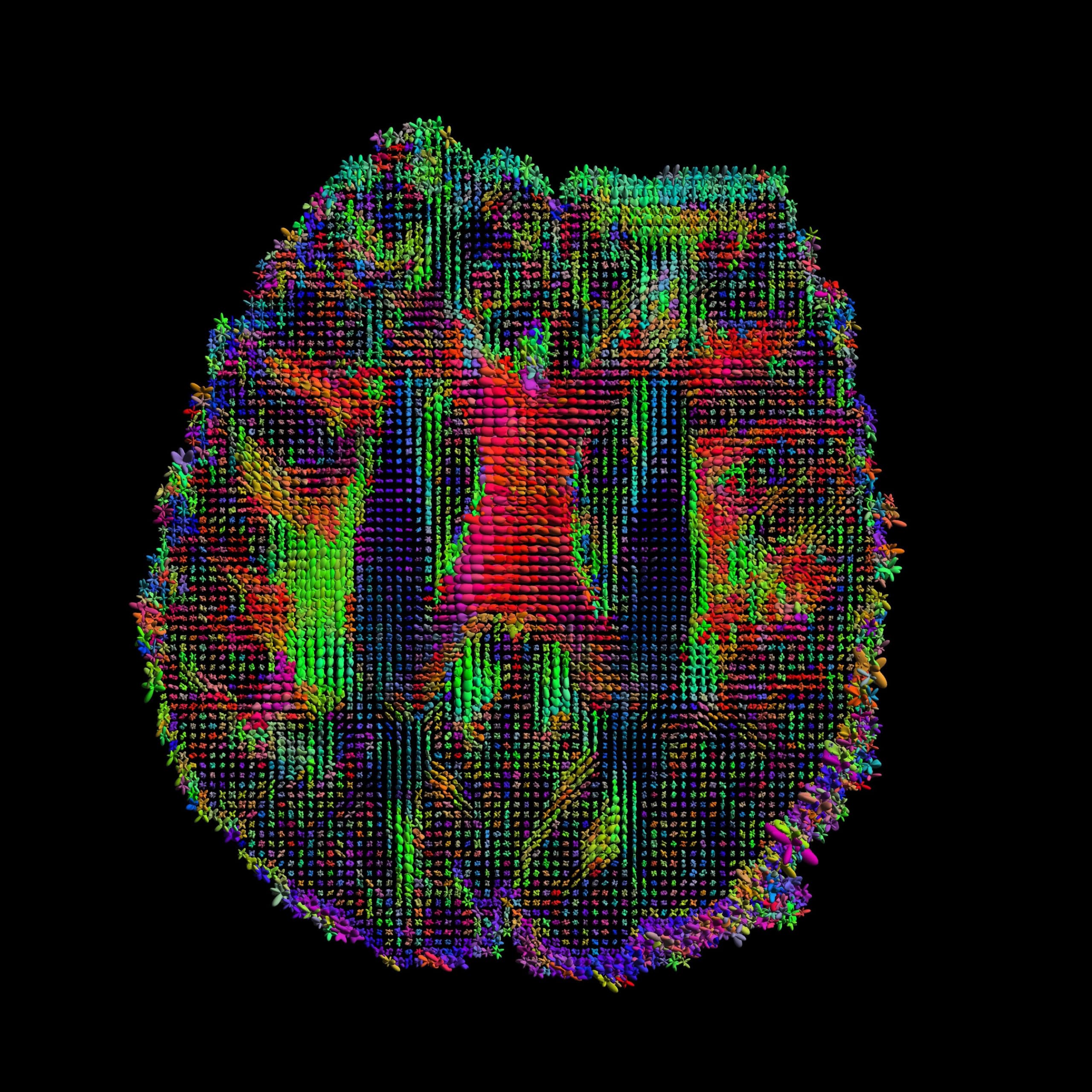 The Human Connectome Project