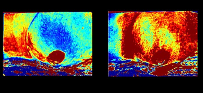 fhash radiation