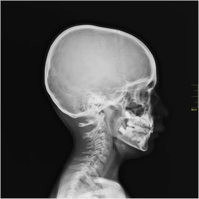 An image of a human skull An image of a human skull
