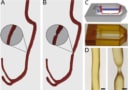 3D-printed microfluidic blood vessel chip, with and without stenotic defect. Image reproduced from Lab on a Chip CC BY 3.0