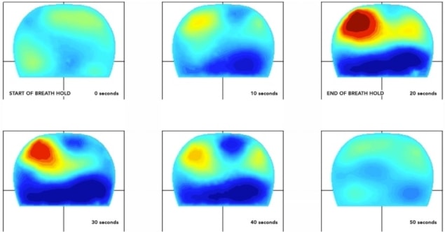 Breast images Breast images