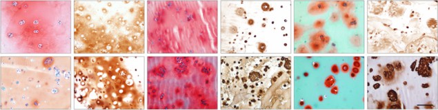 Extracellular cartilage matrix production in gelMA/gellan formulations