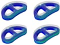 Von Mises stress distribution for the (cross-section) of model of lumbar cage design