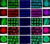 Laser printing of stem cells