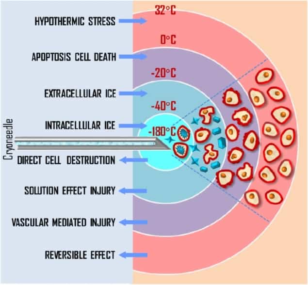 Biological effects of cryotherapy