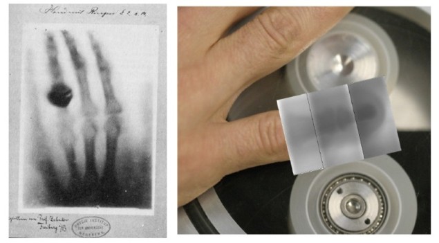 X-ray imaging: from past to present