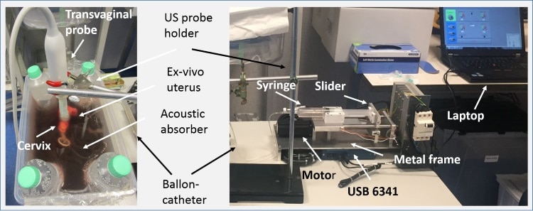 Ex vivo uterus and the experimental setup