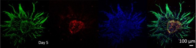 Sprouting of endothelial cells Sprouting of endothelial cells