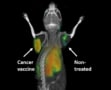 PET scan