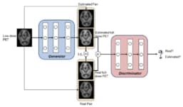 Deep neural networks synthesize full-dose PET images – Physics World