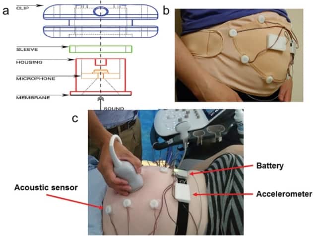 Foetal monitoring system
