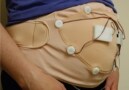 Foetal monitoring
