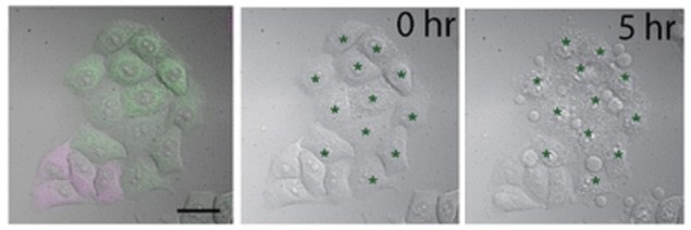 SNG expressing cells