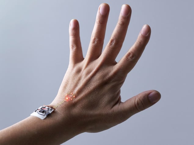 Skin electronics