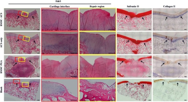 Histology of cartilage defects in pigs after six months