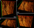 Reconstructed and rendered STEM tomogram