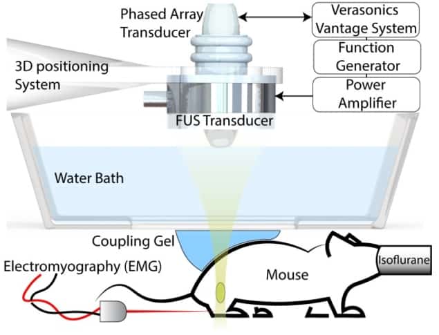 FUS stimulation setup