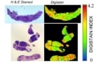 H+E stained and Digistain images