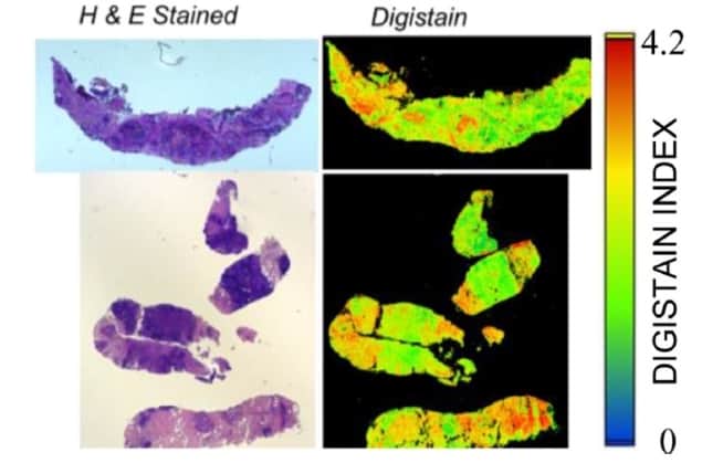 H+E stained and Digistain images