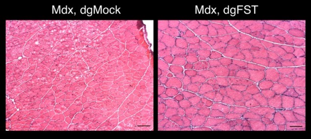 Control and treated muscles