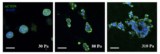Increasing matrix stiffness enhances cell invasion