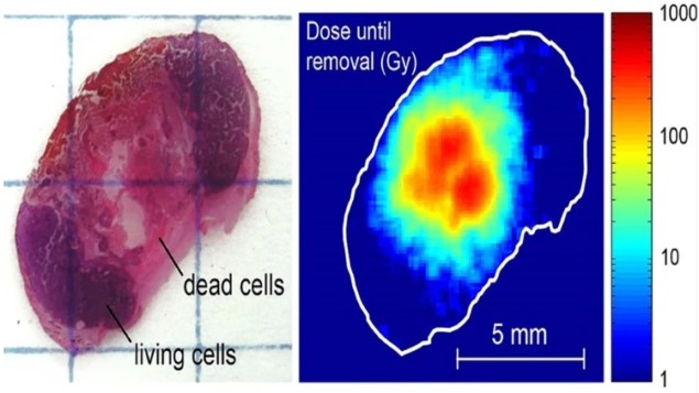 The dose distribution from an Alpha DaRT seed, and the resulting tumour tissue damage The dose distribution from an Alpha DaRT seed, and the resulting tumour tissue damage