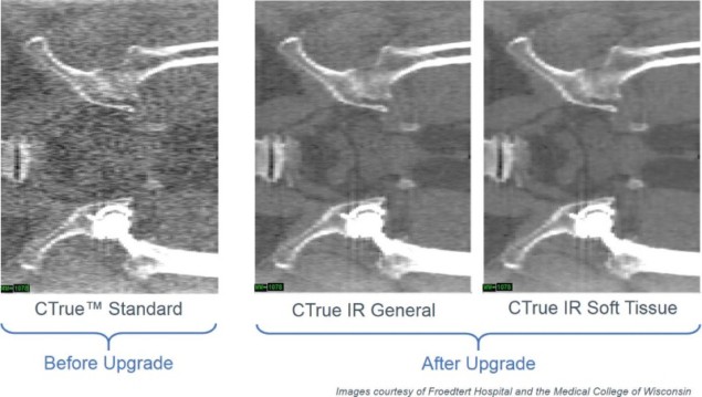 Image reconstruction Image reconstruction