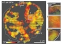 MFM map of platelet integrin forces