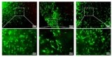 TSPCs in thermosensitive hydrogel