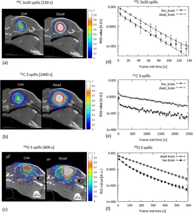 OpenPET images and time activity curves