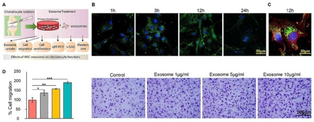 Experiment design and exosomes uptake (click to zoom)