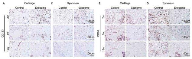 M1 and M2 macrophages in cartilage and synovium