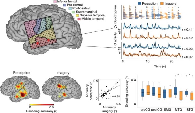 Encoding of auditory perception and imagery