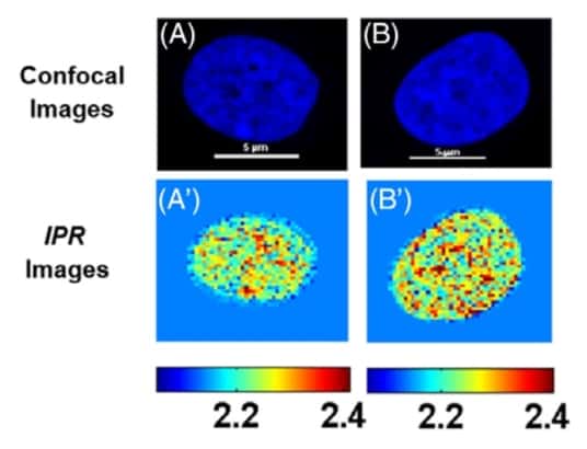 Photonic technique eases cancer staging – Physics World