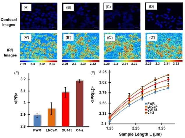 Structural disorder analysis of prostate cells