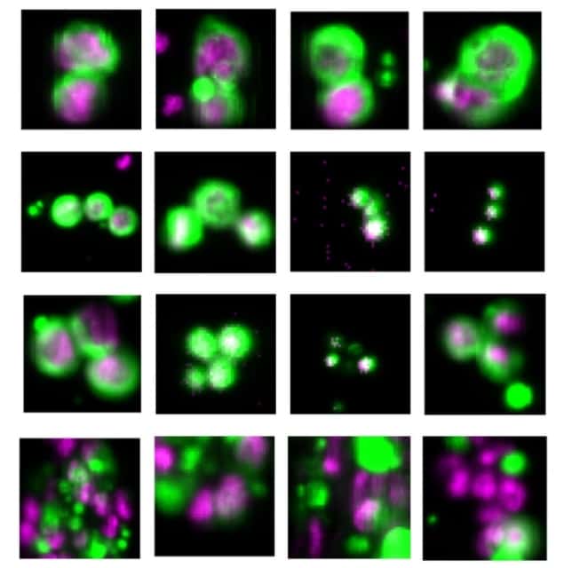 CTCs (green) and DNA (purple)