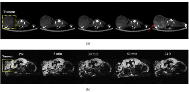 Nanoparticle imaging