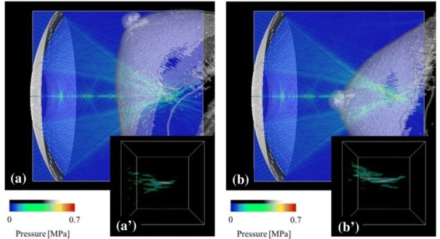 HIFU simulations