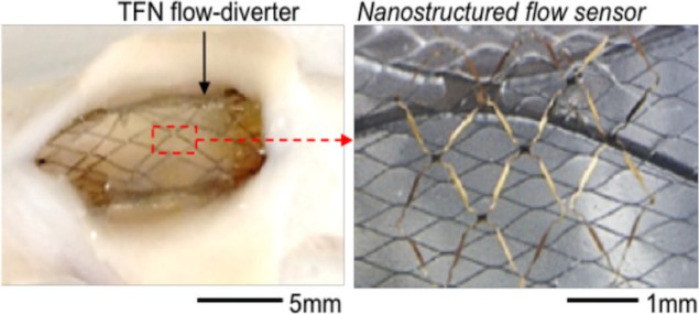 Nanostructured flow-diverter system for quantification of intra-aneurysmal haemodynamics