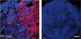 Normalizing tumour blood vessels