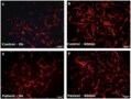 Actin re-polymerization